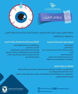 جفاف العين