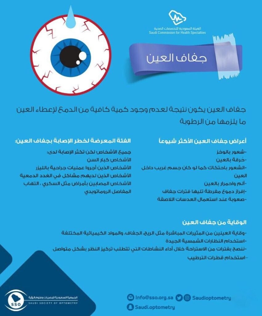 جفاف العين